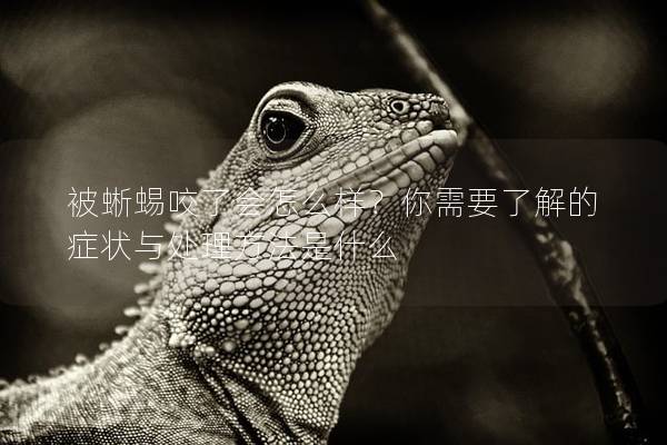 被蜥蜴咬了會怎么樣？你需要了解的癥狀與處理方法是什么